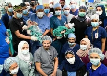 لە سعودیە نەشتەرگەریی جیاكردنەوەی دوانەیەك ئەنجامدرا
